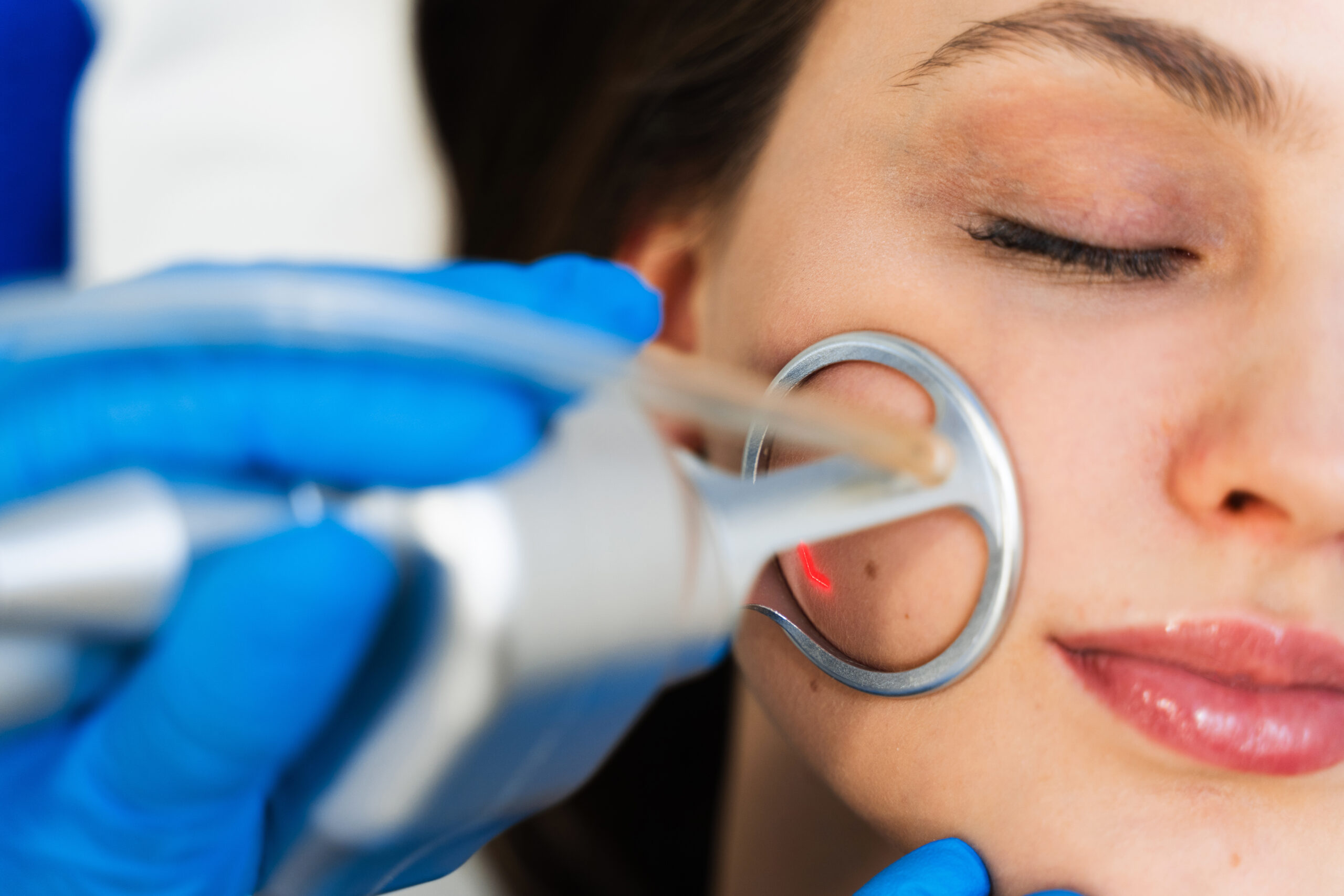 Process of facial CO2 laser resurfacing. Cosmetologist removes wrinkles and scars using laser from face of attractive girl.